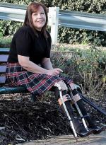 CoromandelValleyBraces