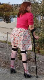 UptotheRotundainBraces